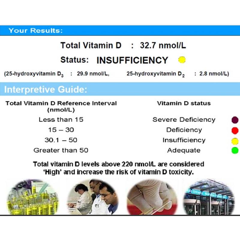 Vitamin D Test